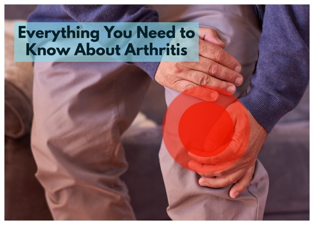 Achieving knowledge of arthritis is necessary for effectively managing the condition.