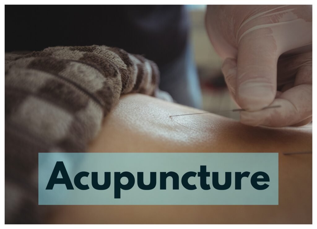 Acupuncture is a Chinese medicine technique that uses small needles to promote healing and reduce pain.