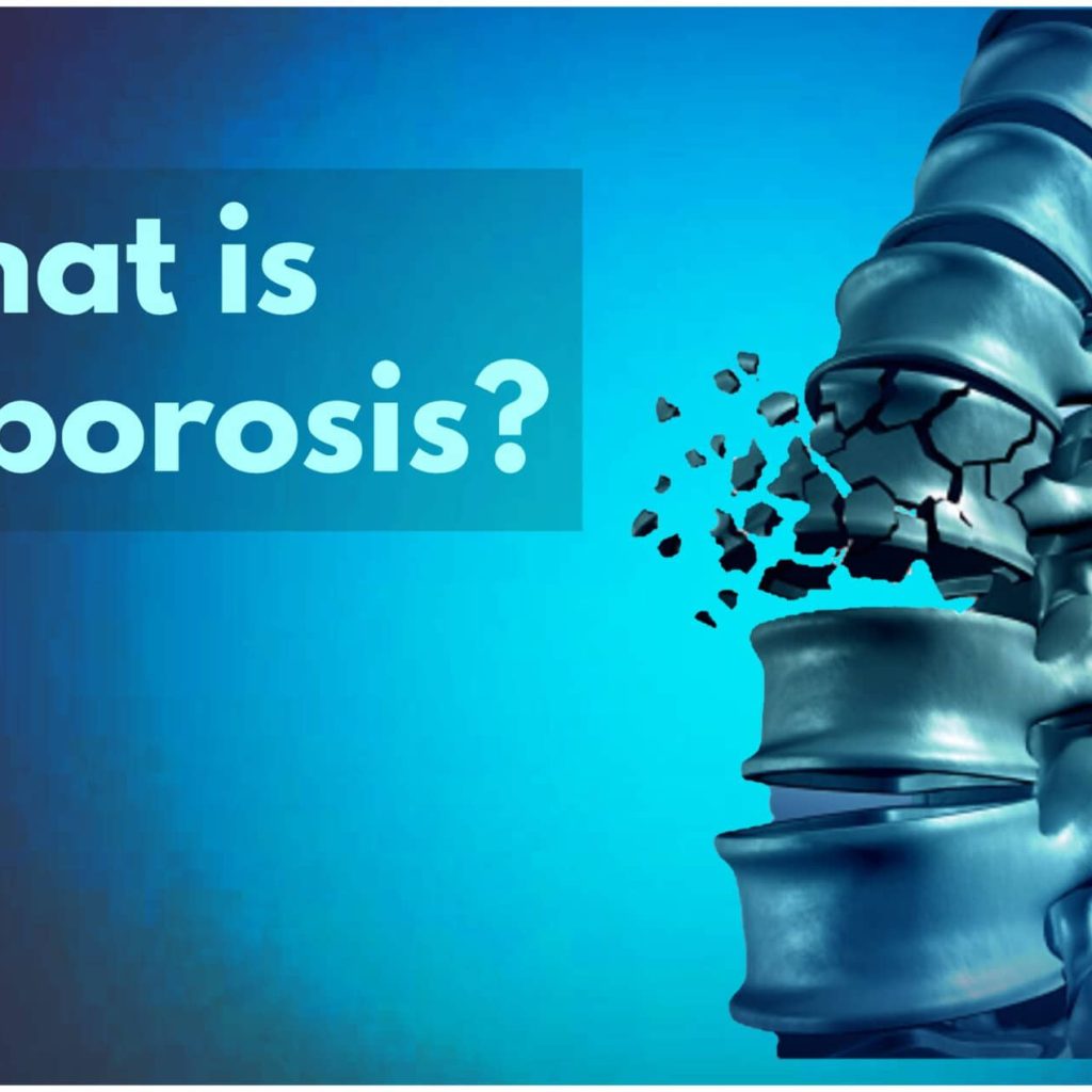 Osteoporosis in seniors is the most common cases recorded.