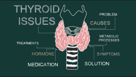 The Impact of Hypothyroidism on Aging: Symptoms, Treatment, and Prevention