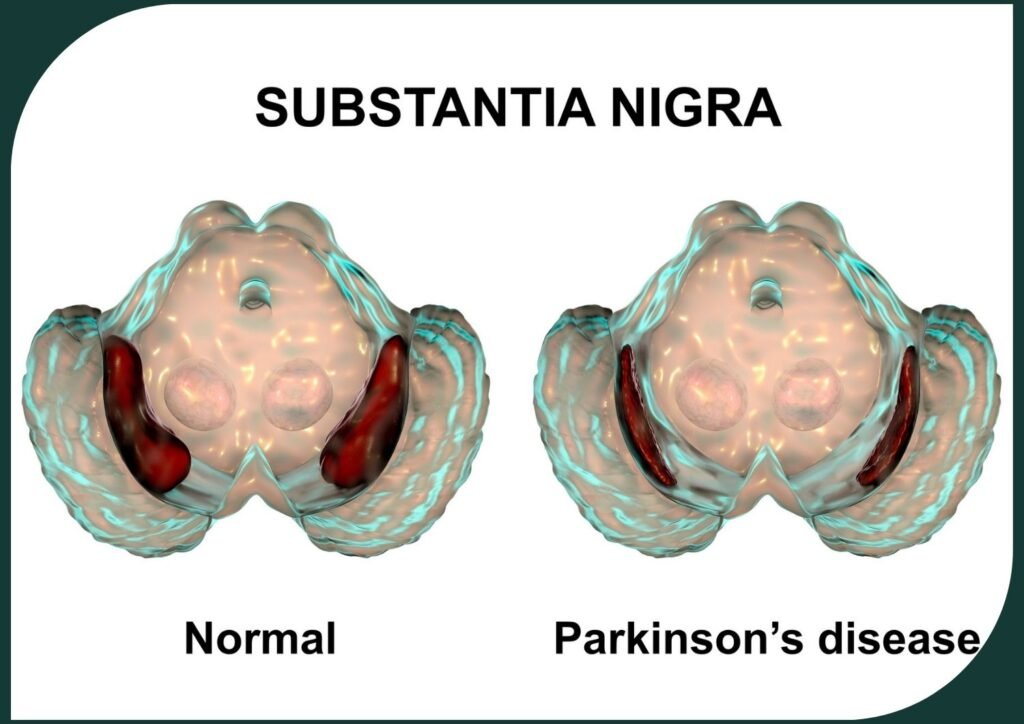 Proven Tips for Living with Parkinson's A Positive Guide for Seniors and Caregivers!