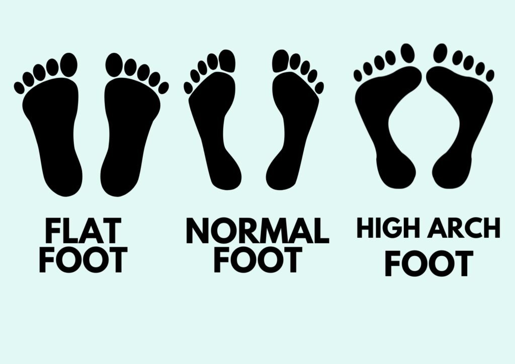 Foot types