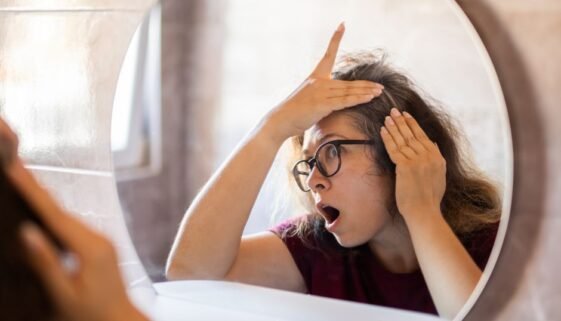 Luteolin: The Veggie Antioxidant Preventing Gray Hair