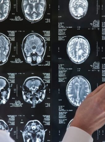 One MRI, One Snapshot — and Insights Into Your Aging Journey