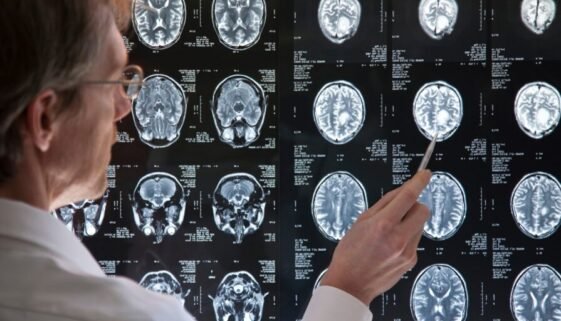 One MRI, One Snapshot — and Insights Into Your Aging Journey