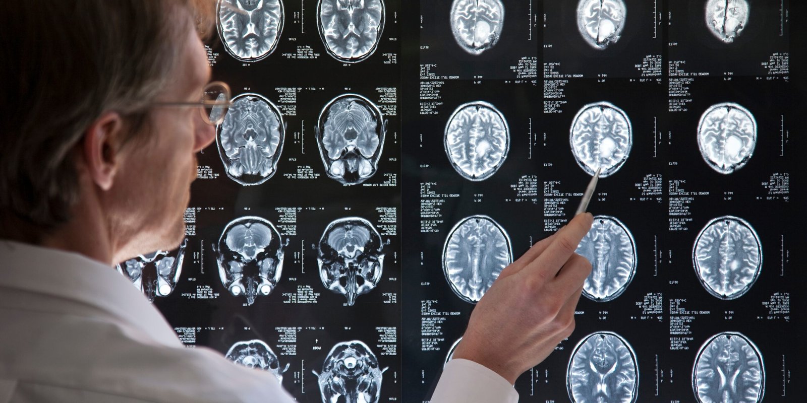 One MRI, One Snapshot — and Insights Into Your Aging Journey