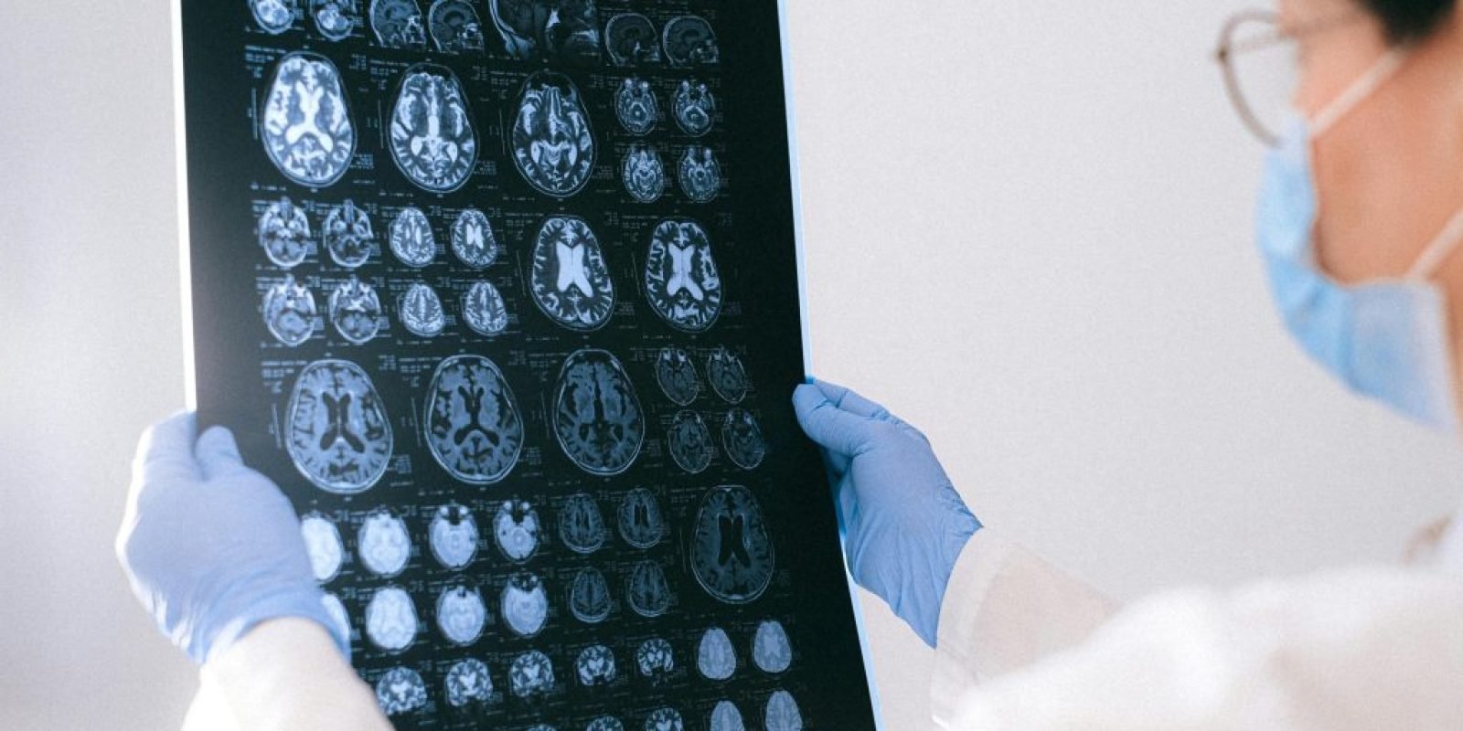 Could One Protein Unlock a Younger Brain?