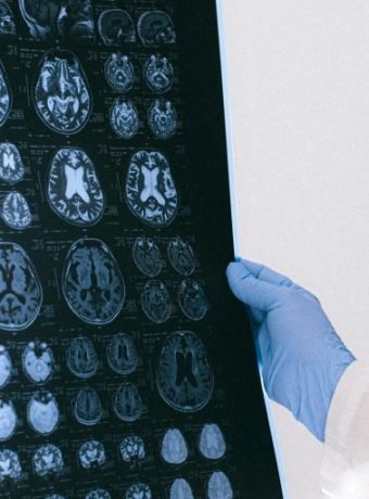 Could One Protein Unlock a Younger Brain?