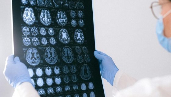 Could One Protein Unlock a Younger Brain?